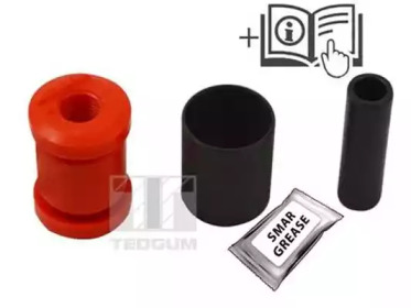 TEDGUM 00087510 -  