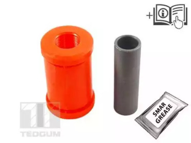 TEDGUM 00227867 -