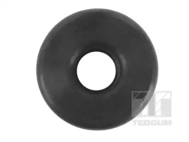 TEDGUM 00302781 -  